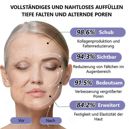 🛡️DE Offizieller Marken-Shop | Turonu® Faltenreduzierende & straffende Roller-Creme 🧴 Glattere Haut in nur 3 Tagen