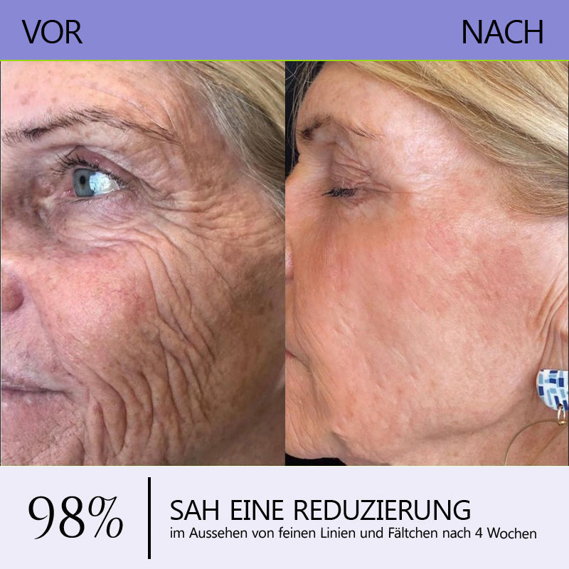 🛡️DE Offizieller Marken-Shop | Turonu® Faltenreduzierende & straffende Roller-Creme 🧴 Glattere Haut in nur 3 Tagen