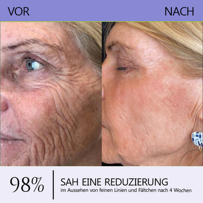 🛡️DE Offizieller Marken-Shop | Turonu® Faltenreduzierende & straffende Roller-Creme 🧴 Glattere Haut in nur 3 Tagen