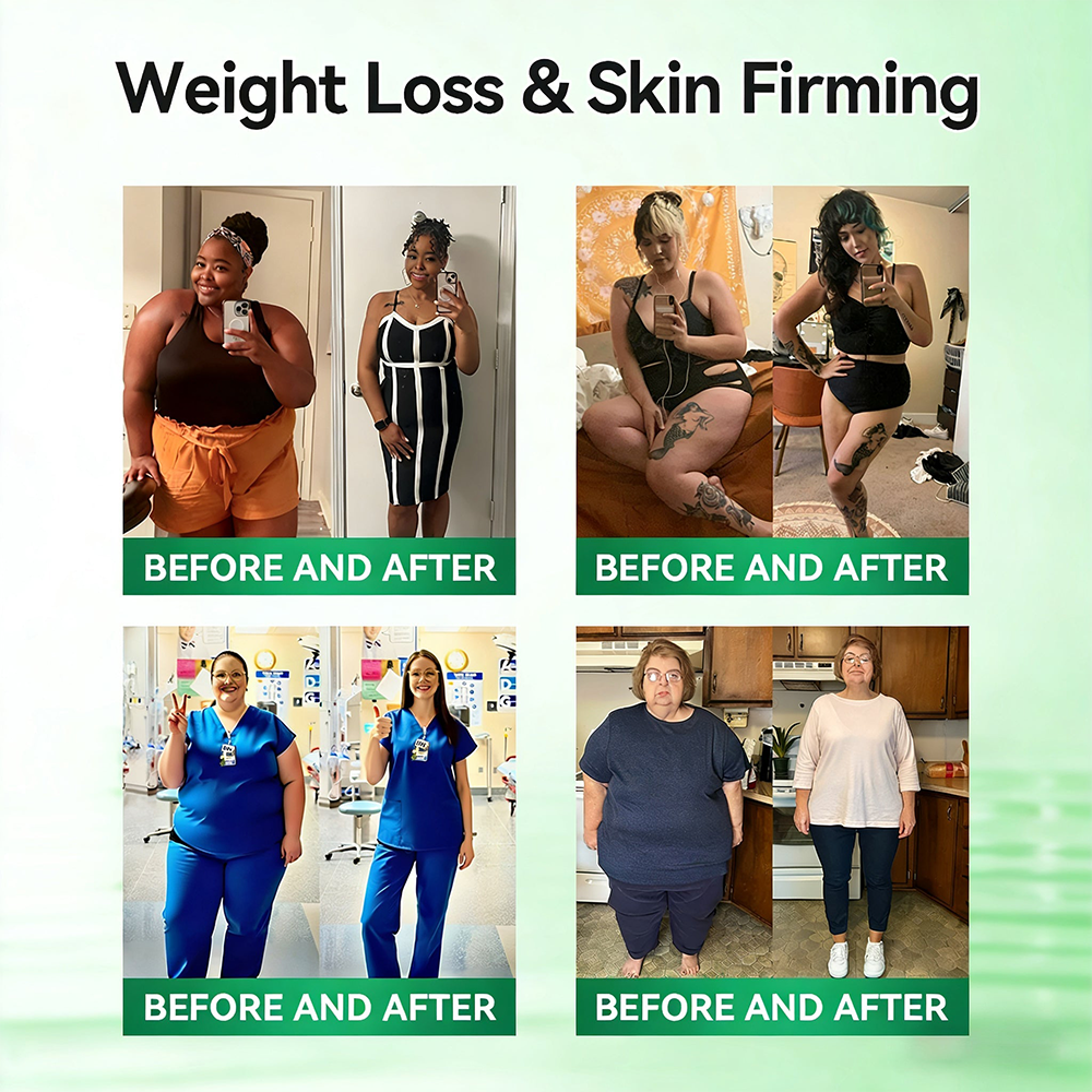 🇺🇸𝑶𝒇𝒇𝒊𝒄𝒊𝒂𝒍 𝑺𝒕𝒐𝒓𝒆  | 🌱 𝐇𝐞𝐚𝐥𝐫𝐢𝐳𝐞® 𝙈𝒐𝒓𝒊𝒏𝒈𝗮 · 𝗕𝗲𝗿𝗯𝐞𝐫𝐢𝐧𝙚 × 𝙉𝑨𝑫+ 𝟏𝟎-𝙞𝙣-𝟏 𝘼𝒅𝒗𝒂𝒏𝒄𝒆𝐝 𝐍𝐚𝐧𝙤 𝙈𝙞𝙘𝙧𝙤𝙣𝒆𝒆𝒅𝒍𝐞 𝐏𝐚𝐭𝙘𝙝(𝐉𝐮𝐬𝐭 𝐨𝐧𝐜𝐞 𝐚 𝐝𝐚𝐲, 𝐯𝐢𝐬𝐢𝐛𝐥𝐞 𝐜𝐡𝐚𝐧𝐠𝐞𝐬 𝐢𝐧 𝟕 𝐝𝐚𝐲𝐬） ✅ 𝐅𝐨𝐫 𝐨𝐛𝐞𝐬𝐢𝐭𝐲, 🅛🅞🅞🅢🅔 🅢🅚🅘🅝,𝐝𝐢𝐚𝐛𝐞𝐭𝐞𝐬, 𝐬𝐥𝐞𝐞𝐩 𝐚𝐩𝐧𝐞𝐚, 𝐣𝐨𝐢𝐧𝐭 𝐢𝐬𝐬𝐮𝐞𝐬, 𝐚𝐧𝐝 𝐦𝐨𝐫𝐞