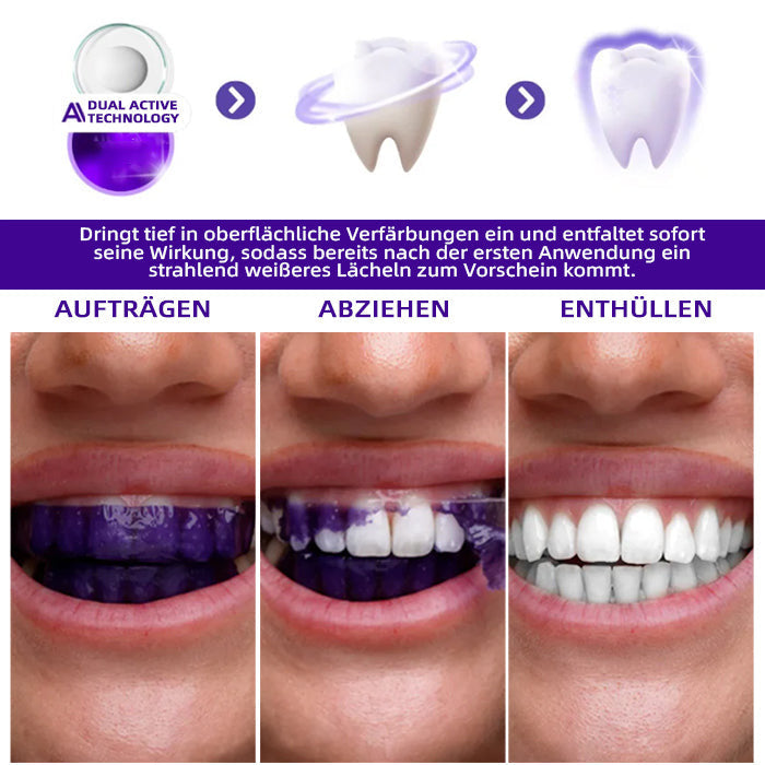 Offizieller Shop | 🦷𝑮𝒂𝒓𝒂𝒈𝒆𝑳𝒊𝒏𝒆® Lila Zahnaufhellungsstreifen👩🏼‍⚕ (Behandelt Parodontitis, beugt Zahnverlust vor und repariert Zahnfleischrückgang)