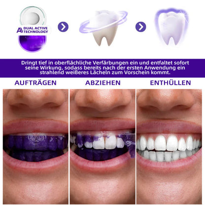Offizieller Shop | 🦷𝑮𝒂𝒓𝒂𝒈𝒆𝑳𝒊𝒏𝒆® Lila Zahnaufhellungsstreifen👩🏼‍⚕ (Behandelt Parodontitis, beugt Zahnverlust vor und repariert Zahnfleischrückgang)
