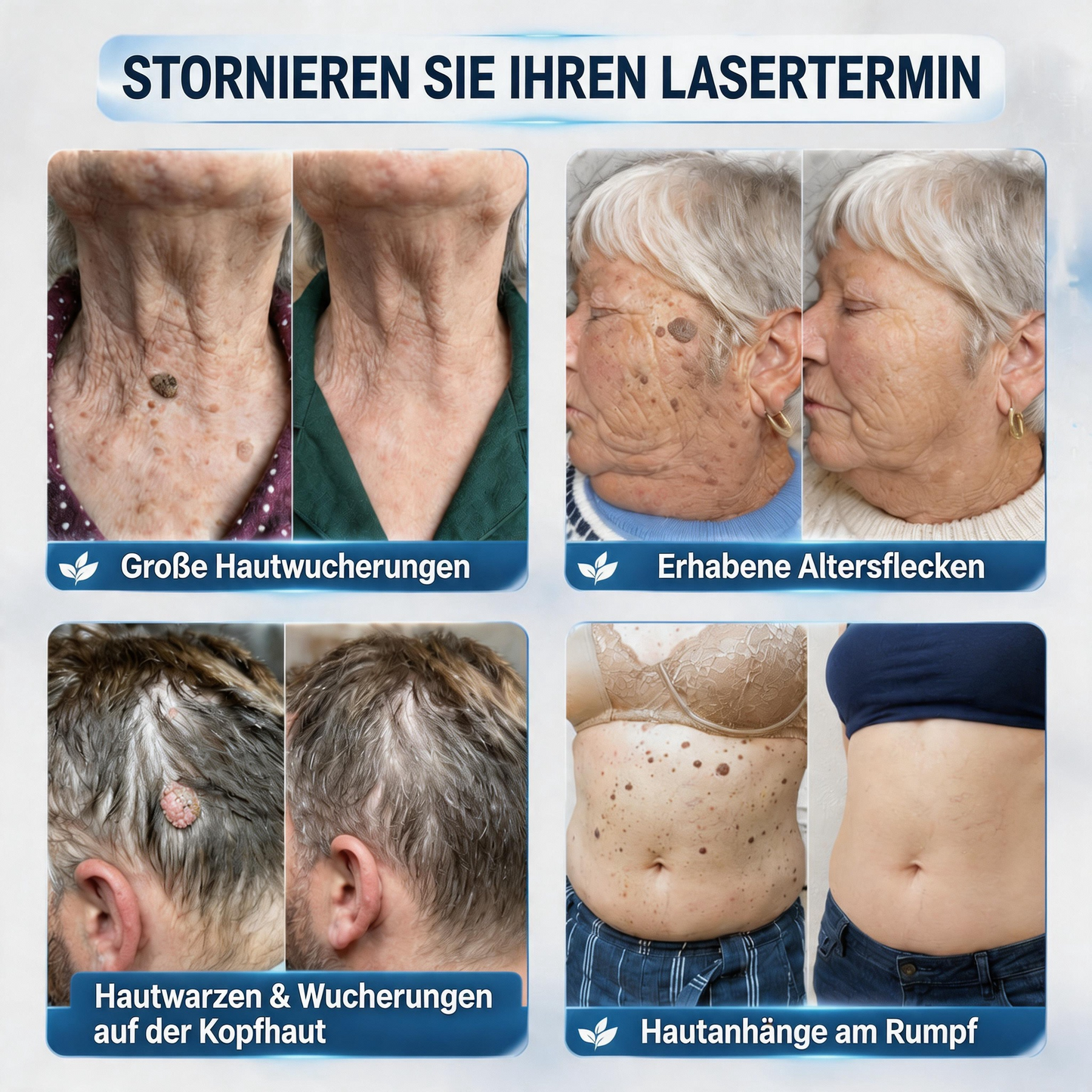 🛡️🛡️CureVivo® 💥💥7-Tage Hautanhängsel- & Flecken-Entfernungscreme (schmerzfreie Formel – ohne Narben)